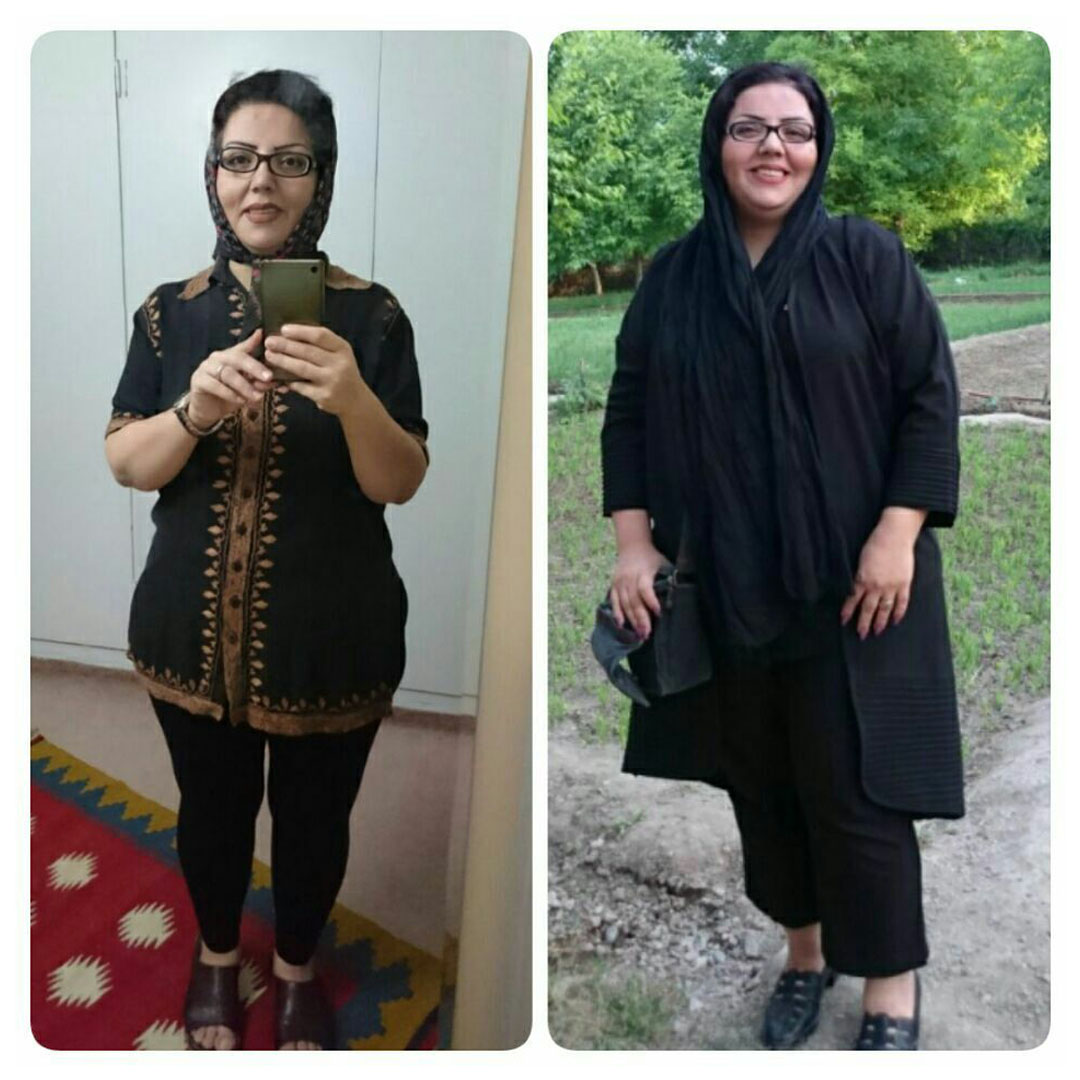 قبل و بعد از عمل