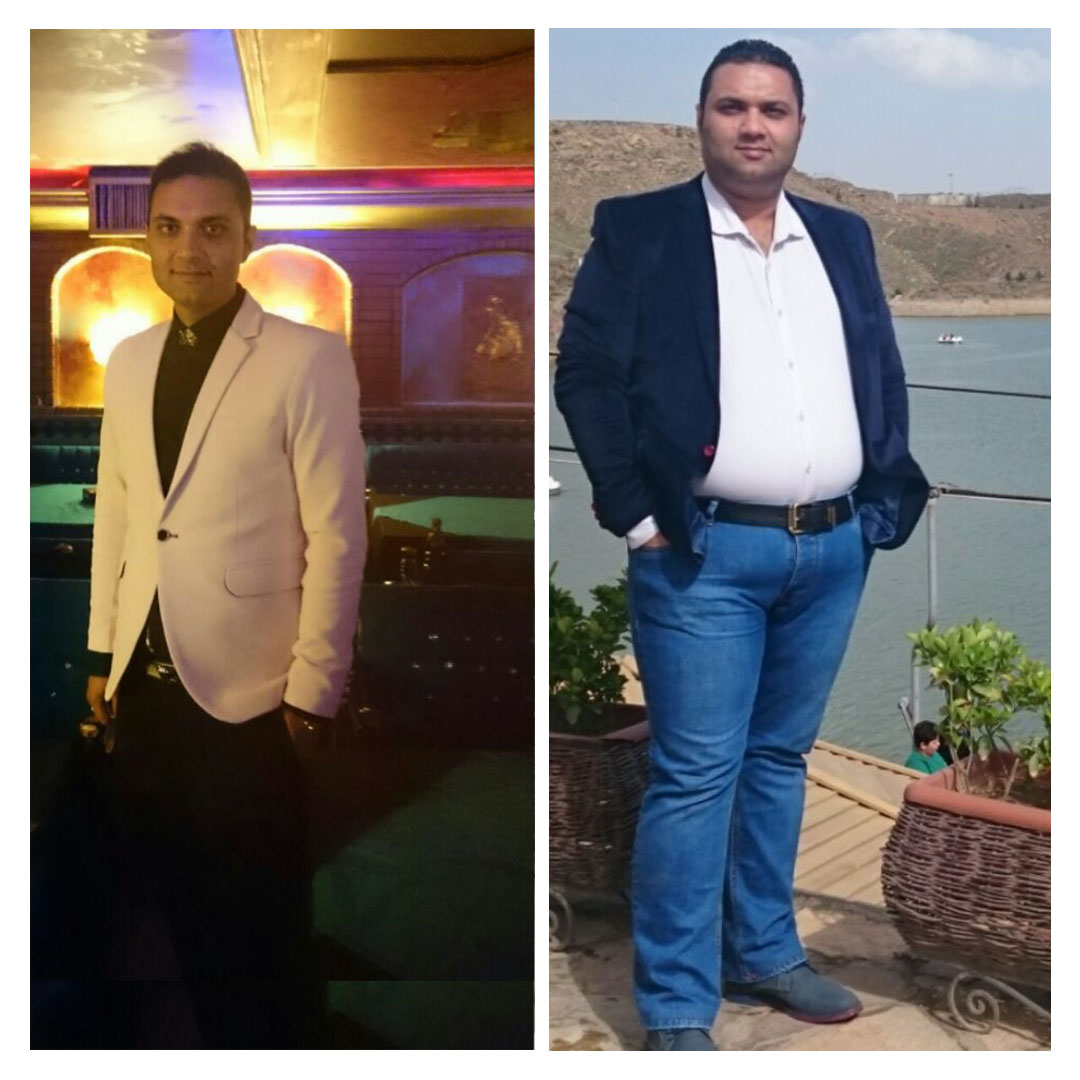 قبل و بعد از عمل