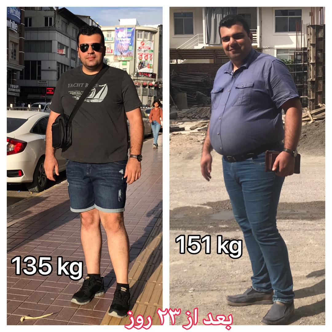 قبل و بعد از عمل