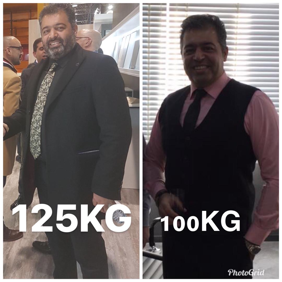 قبل و بعد از عمل