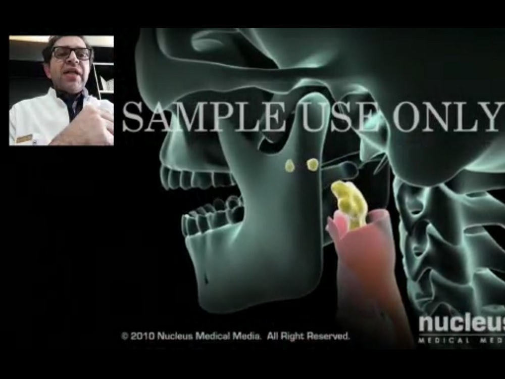 مشکل ترش کردن یا ریفلاکس معده  و فتق هیاتال